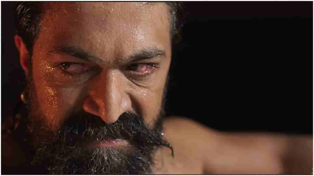 ಯಶ್ ಅಭಿನಯದ ‘ಟಾಕ್ಸಿಕ್’ ಸಿನಿಮಾದ ಎರಡನೇ ಭಾನುವಾರದ ಗಳಿಕೆಯ ವಿವರ ಹೀಗಿದೆ