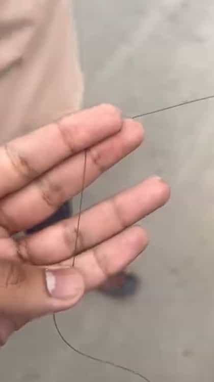 ಬೆಂಗಳೂರಲ್ಲಿ ವ್ಯಕ್ತಿಯ ಕುತ್ತಿಗೆ ಸೀಳಿದ ಮಾಂಜಾ ದಾರ