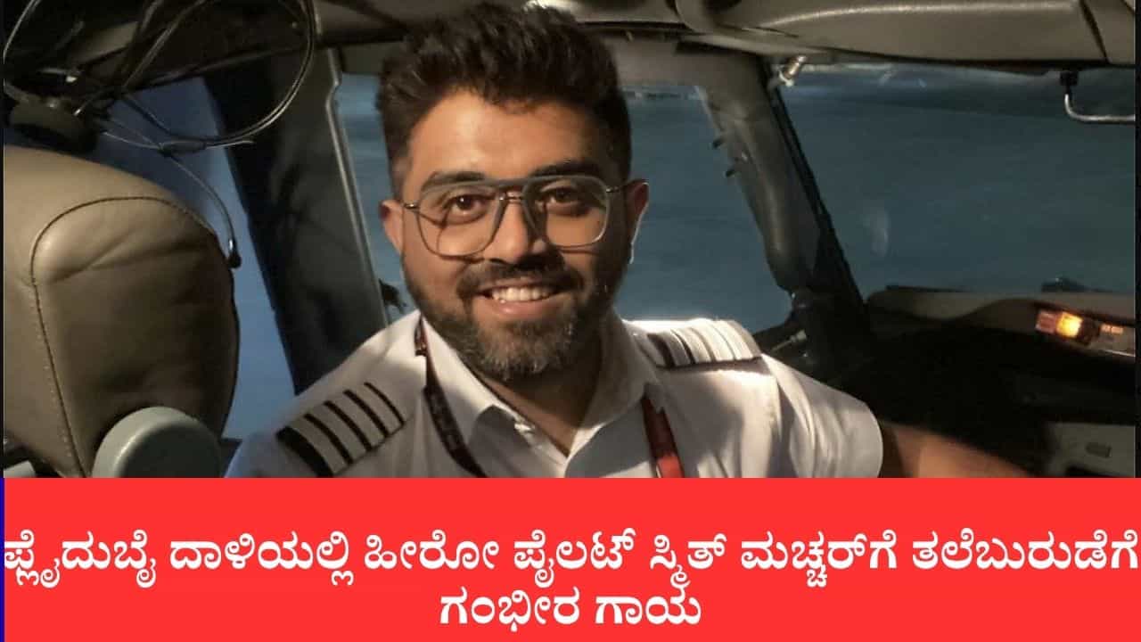 ಫ್ಲೈದುಬೈ ದಾಳಿಯಲ್ಲಿ ಹೀರೋ ಪೈಲಟ್ ಸ್ಮಿತ್ ಮಚ್ಚರ್ಗೆ ತಲೆಬುರುಡೆಗೆ ಗಂಭೀರ ಗಾಯ: ಸೌದಿಯಲ್ಲಿ ತುರ್ತು ಶಸ್ತ್ರಚಿಕಿತ್ಸೆ ಫ್ಲೈದುಬೈ ದಾಳಿಯಲ್ಲಿ ಹೀರೋ ಪೈಲಟ್ ಸ್ಮಿತ್ ಮಚ್ಚರ್ಗೆ ತಲೆಬುರುಡೆಗೆ ಗಂಭೀರ ಗಾಯ: ಸೌದಿಯಲ್ಲಿ ತುರ್ತು ಶಸ್ತ್ರಚಿಕಿತ್ಸೆ